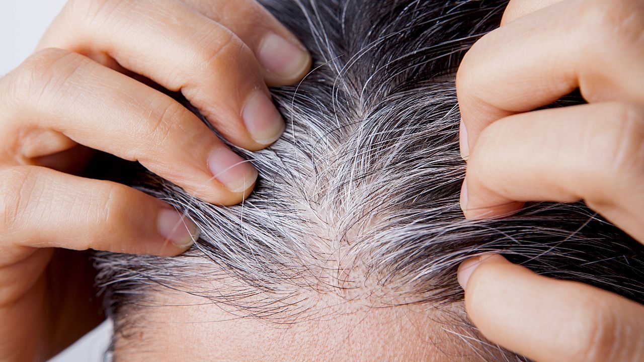 White Hair Causes: समय से पहले सफेद बालों का कारण और बचाव के उपाय