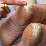 Health Tips: महंगे ड्रैगन फ्रूट की जगह खाएं पपीता और कीवी की जगह आंवला! जानें 3 बजट-फ्रेंडली फल, जिनमें मिलते हैं महंगे विदेशी फ्रूट्स जैसे ही पोषक तत्व